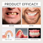 Advanced Customized Full Denture Set, Silicone Reline Denture Set, Soft and Comfortable, Denture Silicone Reline Kit for Men & W