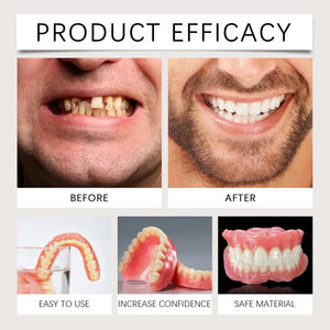 Advanced Customized Full Denture Set, Silicone Reline Denture Set, Soft and Comfortable, Denture Silicone Reline Kit for Men & W