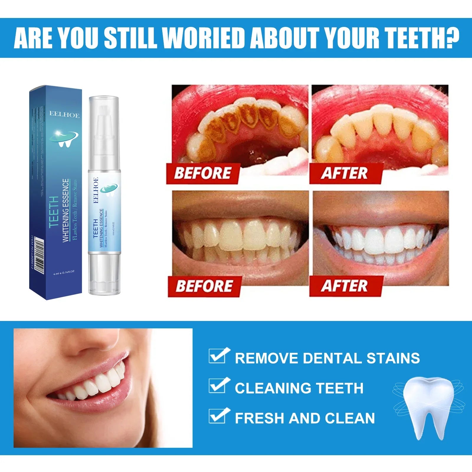 Eelhoe Dental Pen Teeth Whitening Pen Oral Care Remove Teeth Yellow Teeth Whitening Gel White Tooth Whitening Pen Natural